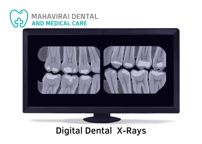 Dental Xrays