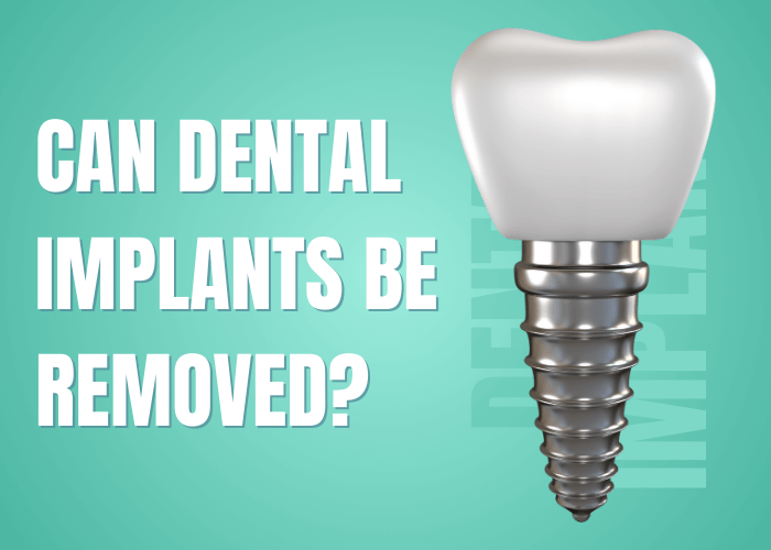 Can Dental Implants be Removed?