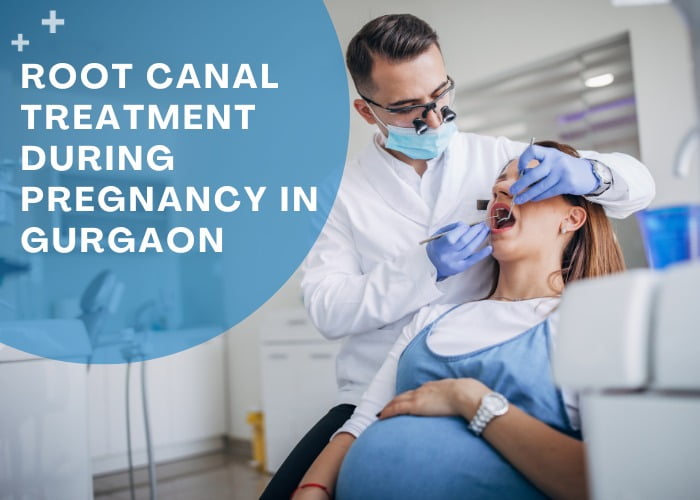 root canal treatment during pregnancy in gurgaon