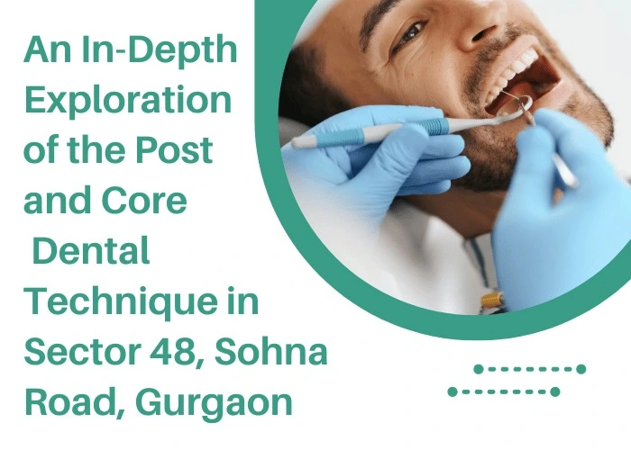 post and core dental in india