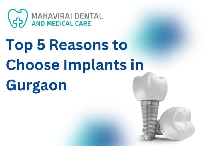 top 5 reason to choose implants in gurgaon